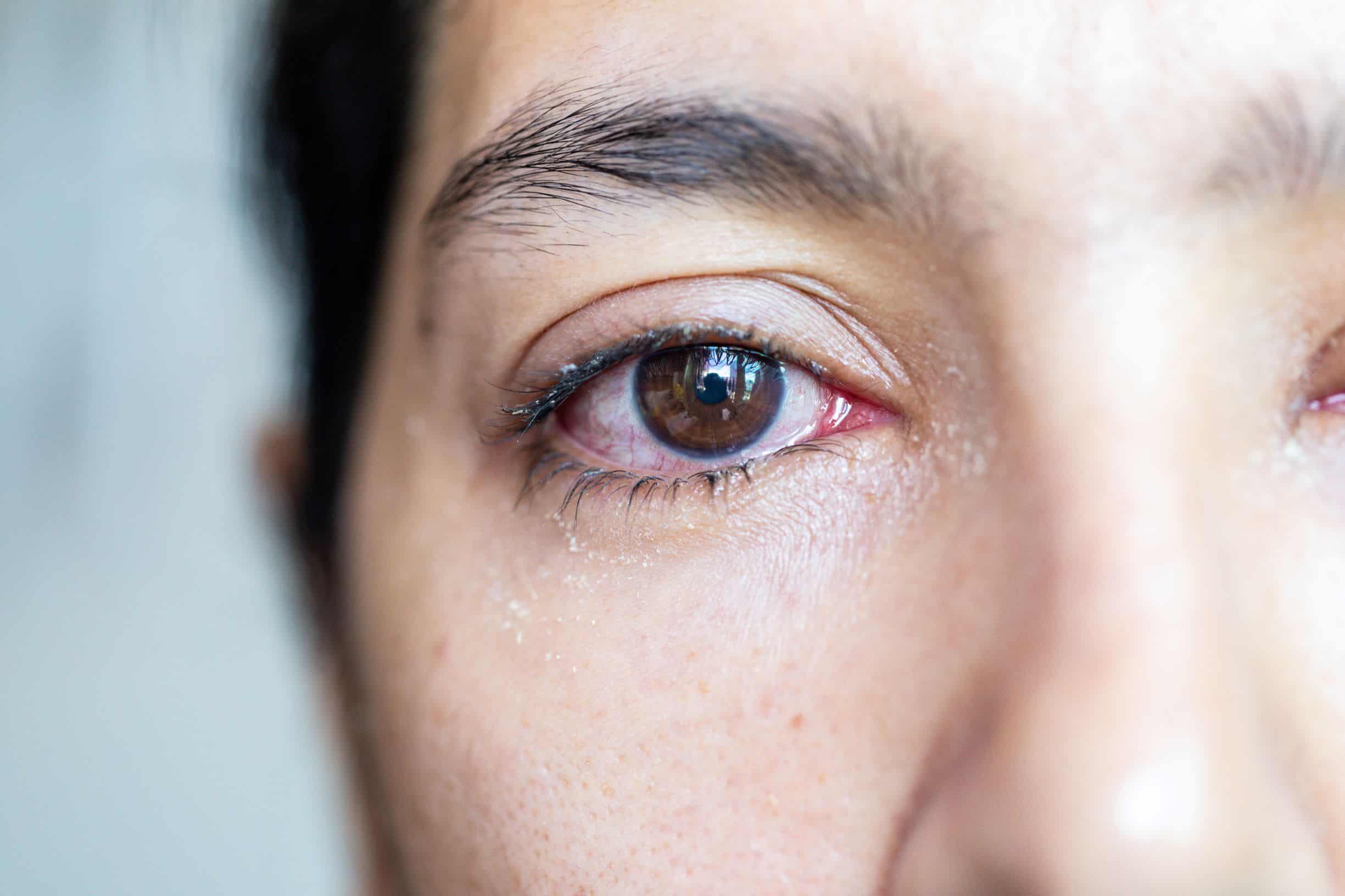10 Things Your Eyes Say About Your Overall Health Healthcare Business